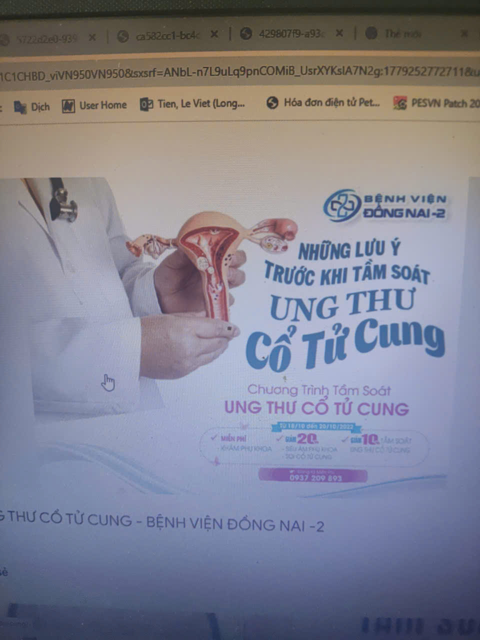 Sức khỏe phụ nữ
